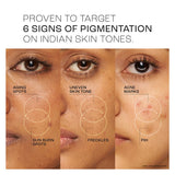 Lakme Perfect Radiance Pigmentation 10Per Treatment Day Gel Creme
