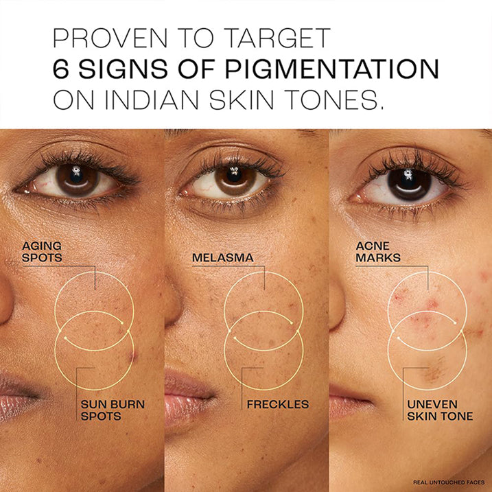 Lakme Perfect Radiance Pigmentation Treatment Serum