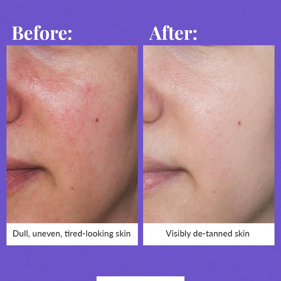 Oliva Detan Cream With Kojic Acid & Rice