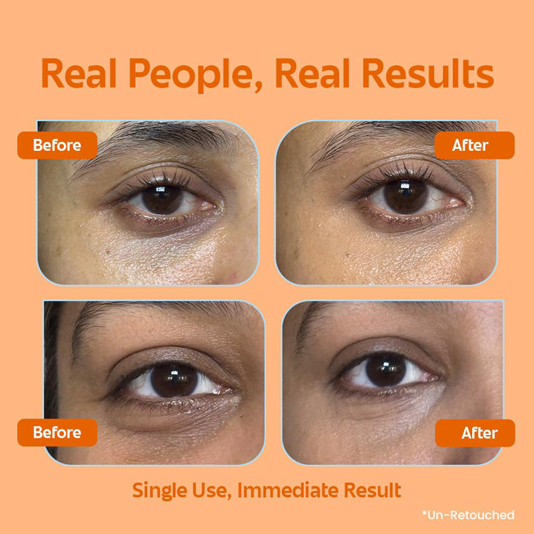 Rivona 2-in-1 Eye Cream Brightening + Concealor