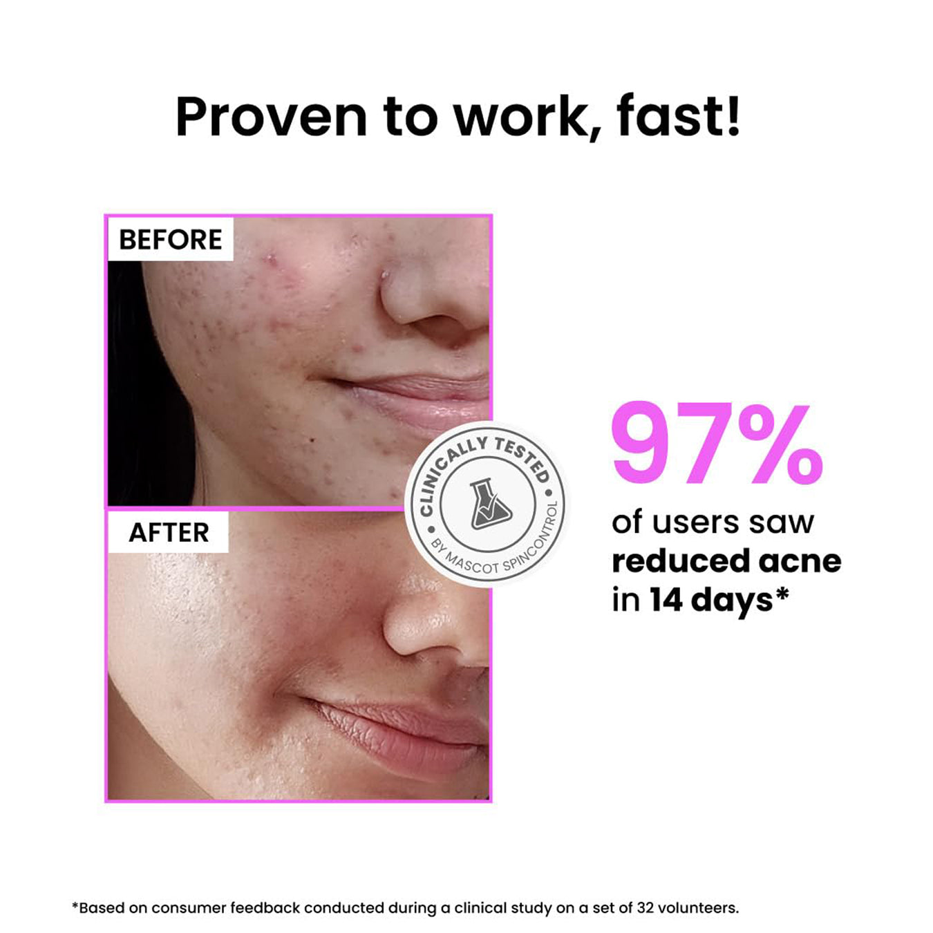Foxtale 12Per Niacinamide Clarifying Serum