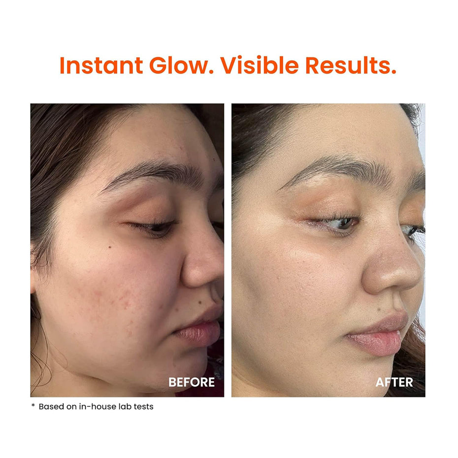 Foxtale Super Glow Moisturizer with Vitamin C & Niacinamide