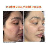 Foxtale Super Glow Moisturizer with Vitamin C & Niacinamide