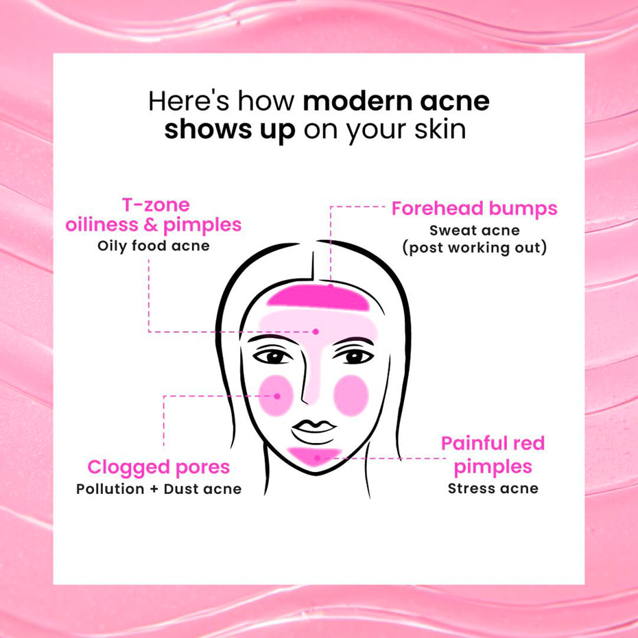 Foxtale Oil & Acne Control Face Wash