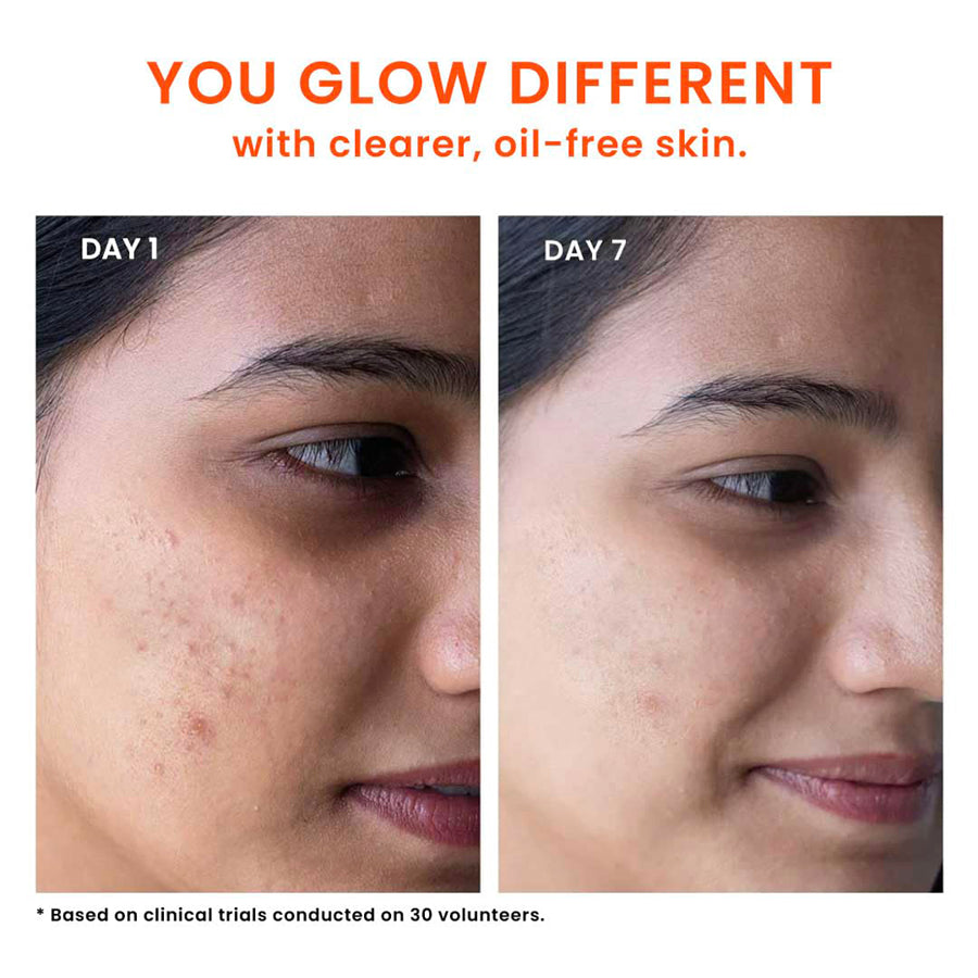 Foxtale Oil & Acne Control Face Wash