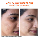 Foxtale Oil & Acne Control Face Wash