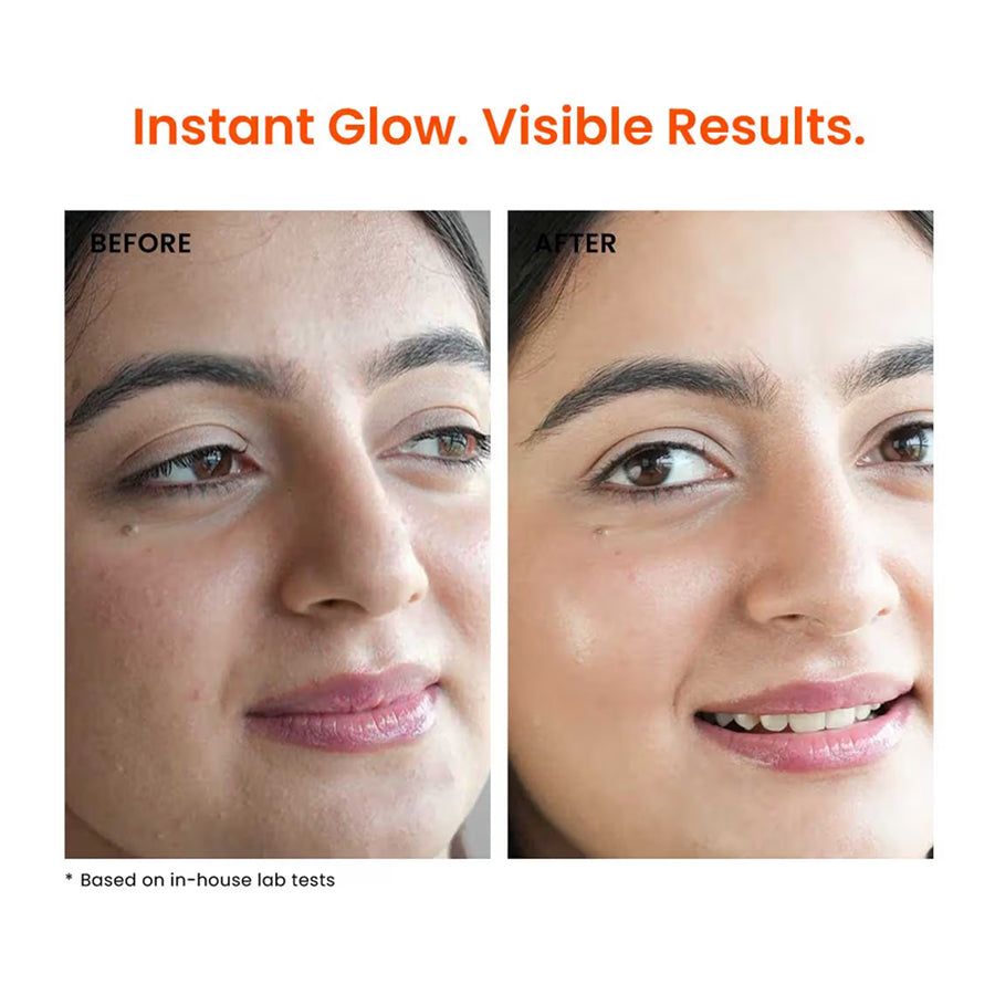 Foxtale The Dazzler Multivitamin Glow Toner + Makeup Setting Spray