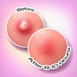 Recode Acne Patch Pack Of 36 Patches