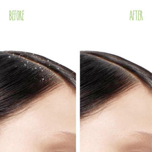 MATRIX BIOLAGE ADVANCED SCALPPURE ANTI DANDRUFF SHAMPOO